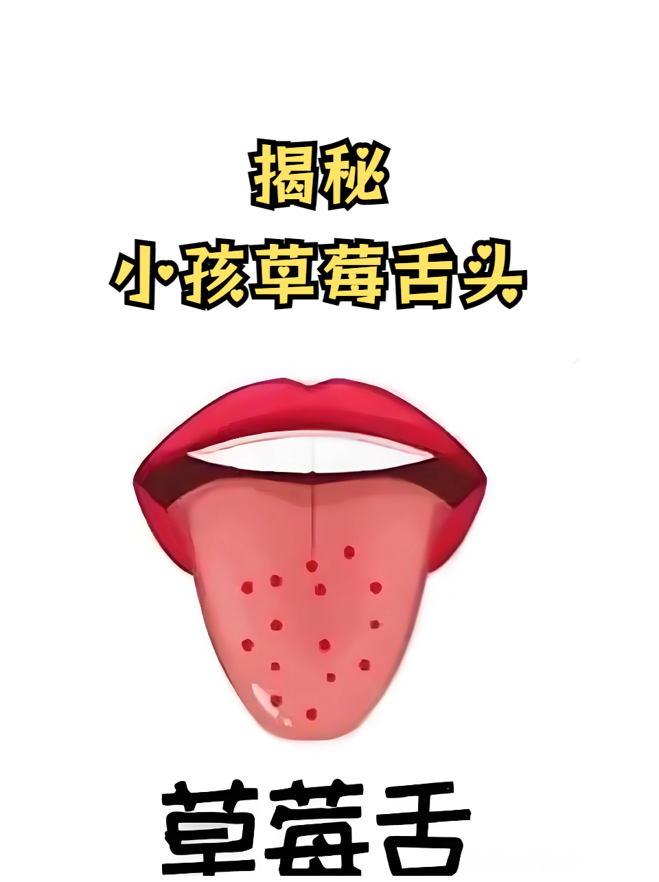 舌头往下舔到一个硬硬的包疼是上火了吗舌头触碰硬包，疼痛的背后-第2张图片