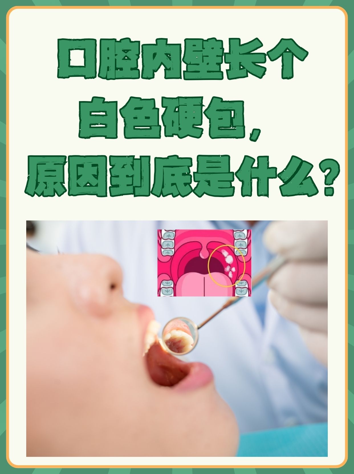 舌头往下舔到一个硬硬的包疼是上火了吗舌头触碰硬包，疼痛的背后-第3张图片