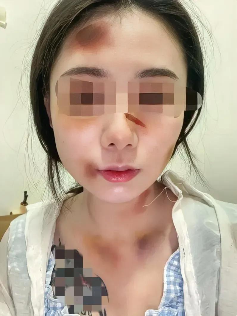火辣辣app福引导内江市免费章节火辣辣APP福引导，点燃生活的新篇章-第1张图片