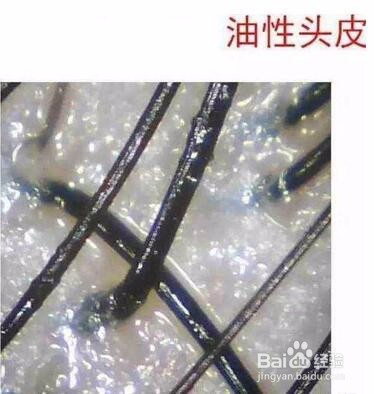 女性尿道周围的毛发，理解、护理与健康-第2张图片