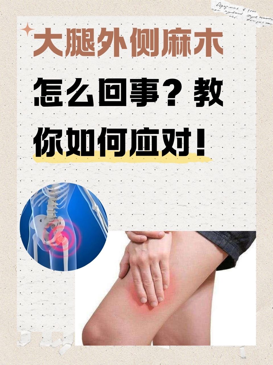 女生迈开腿打扑克又痛又痒怎么办女生遇到打扑克时的不适感，如何应对迈开腿的痛痒问题-第1张图片